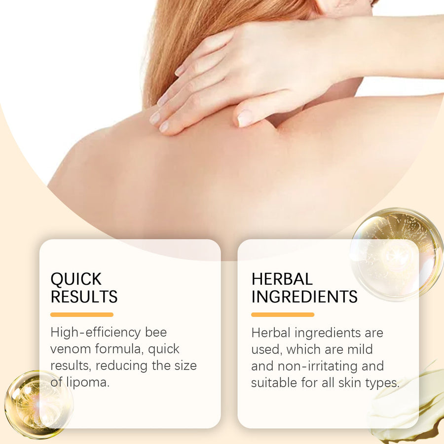 Bee Venom Body Cream — Reduce Lipomas & Fatty Deposits
