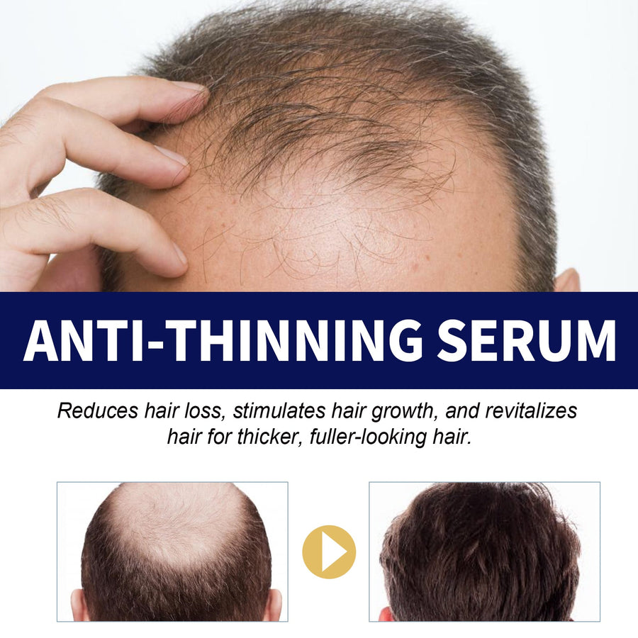 Anti-Thinning Hair Serum for Thicker-Looking Fuller Hair