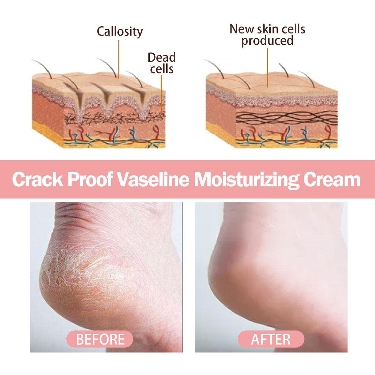 Anti-Crack Hand & Foot Cream Stick for Dry Cracked Heels