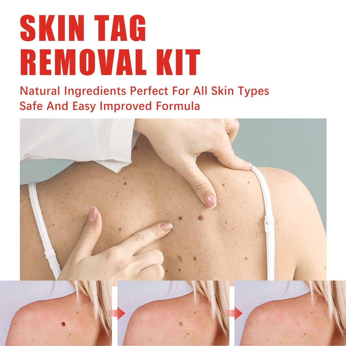 Skin Applicator Pen with Patches