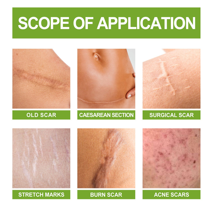 Scar Repair Serum — Flatten & Smooth All Scars in Weeks
