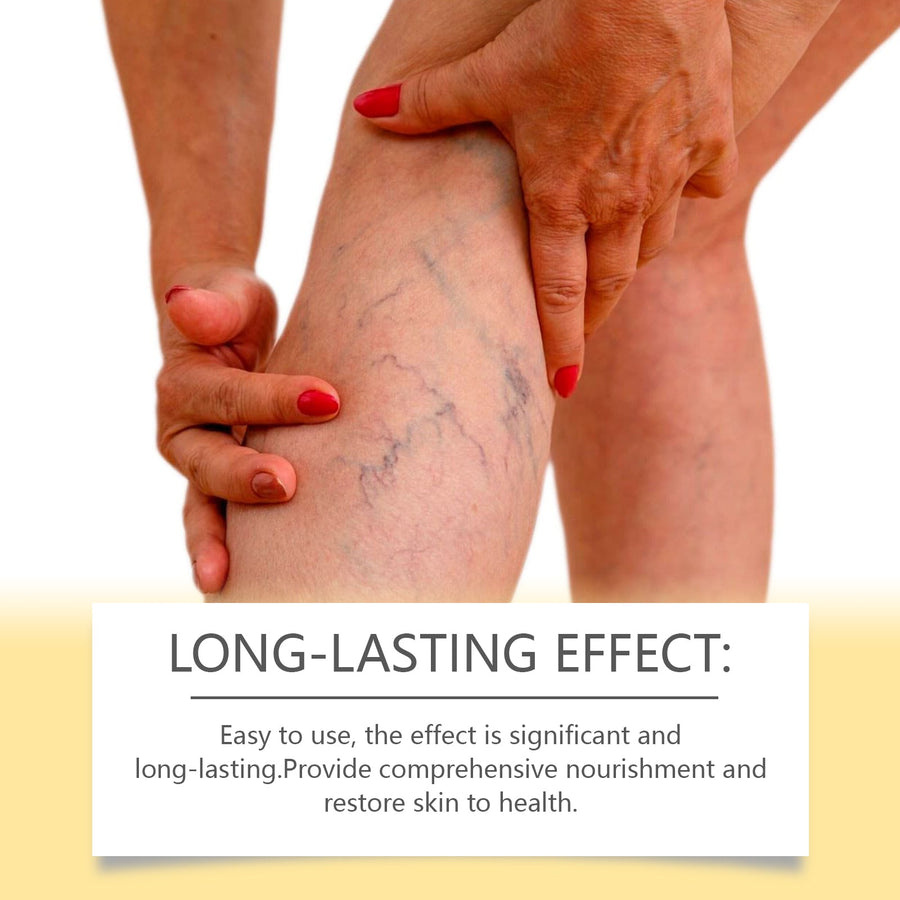 Bee Venom Varicose Cream — Visibly Reduce Vein Appearance