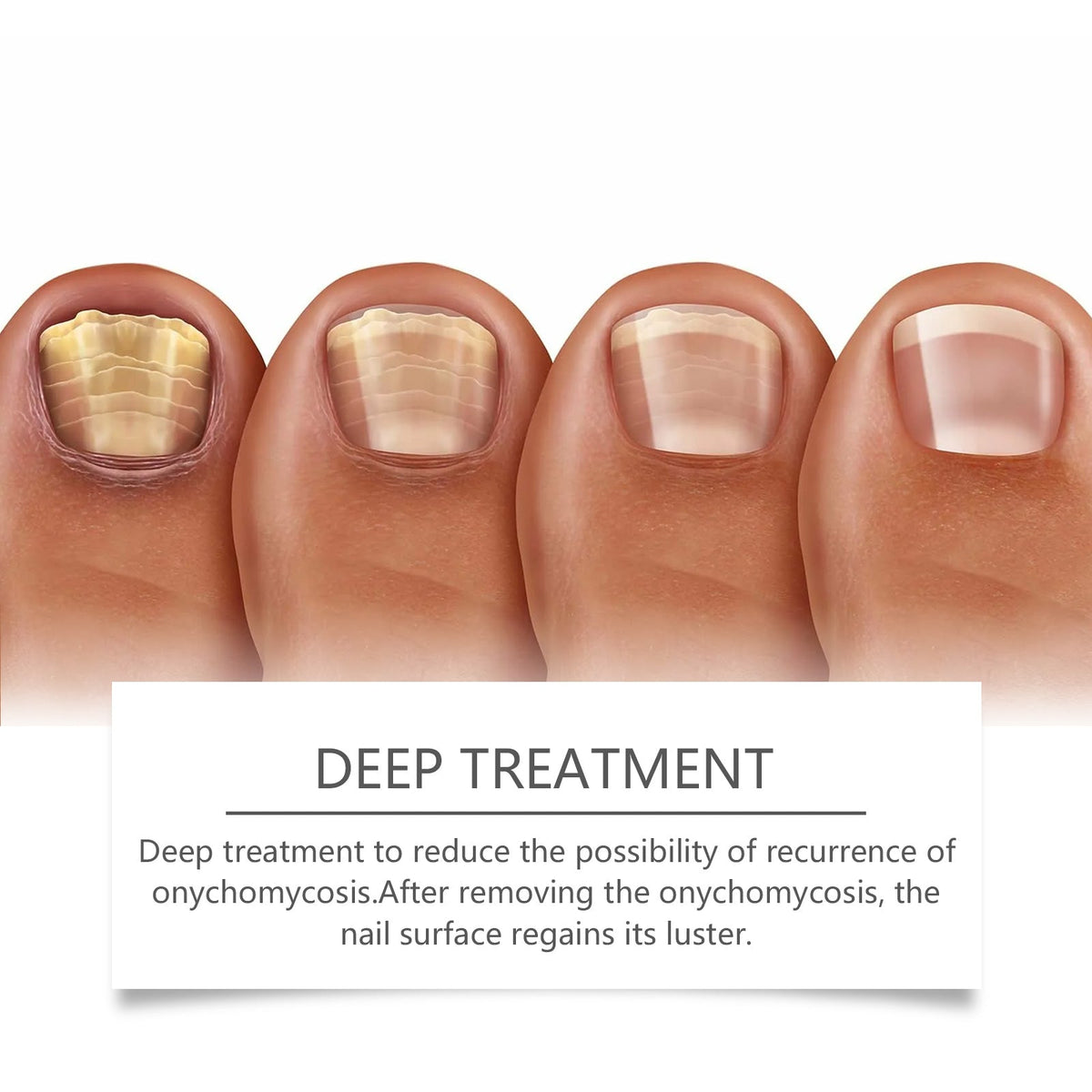 Nail Care Device for Stronger, Healthier-Looking Nails