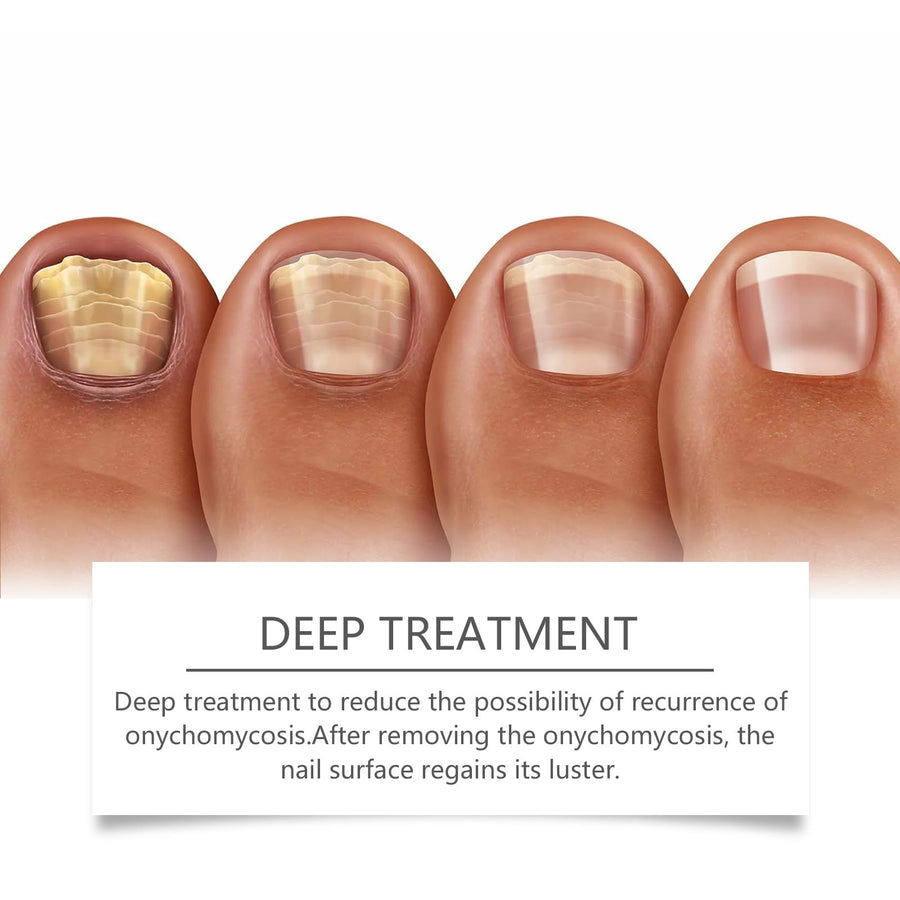 Nail Care Device for Stronger, Healthier-Looking Nails