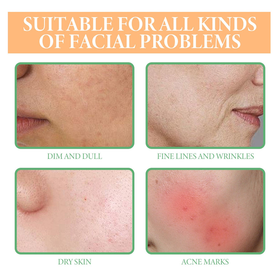 Turmeric Oil Serum for Acne Scars & Dark Spots