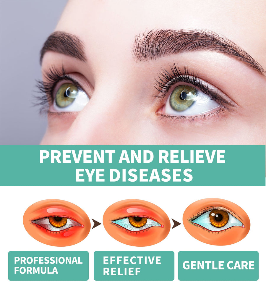 Eye Acupressure Roller — Relieve Dry Eye Fatigue & Enhance