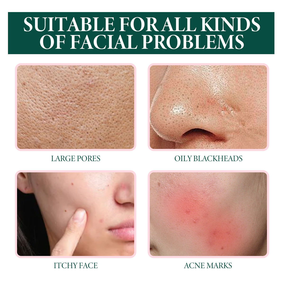 Tea Tree Oil Serum for Redness & Blemish-Prone Skin