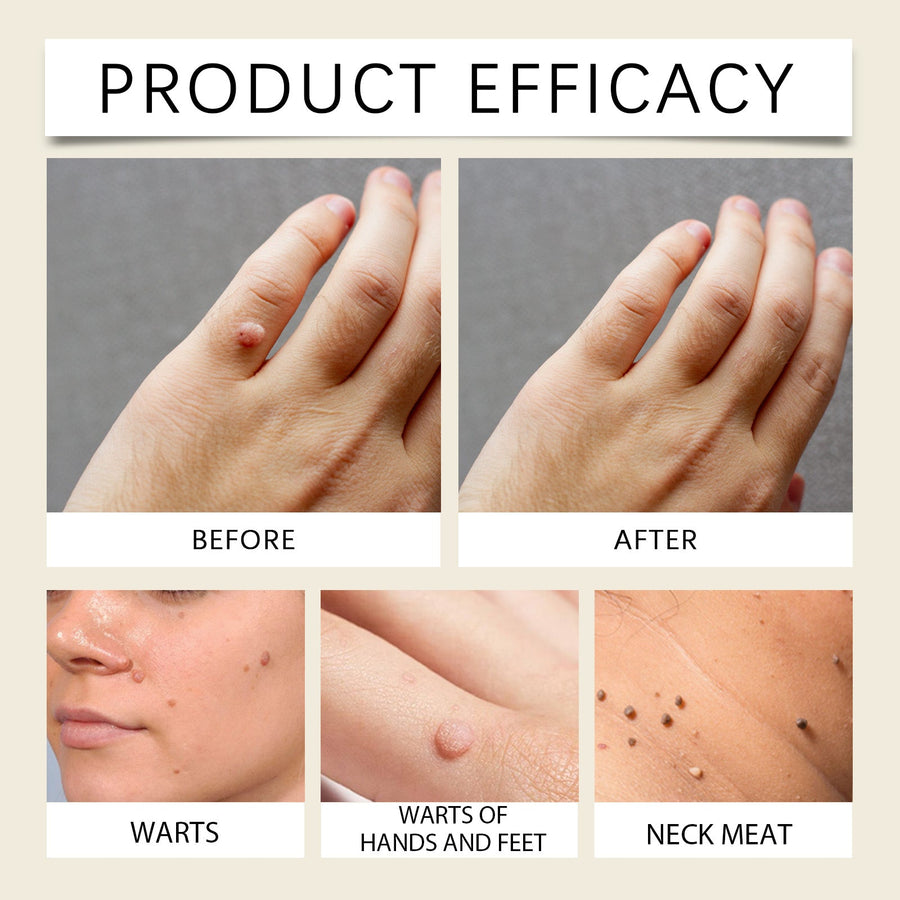 Bee Venom Skin Renewal Cream for Smoother Texture