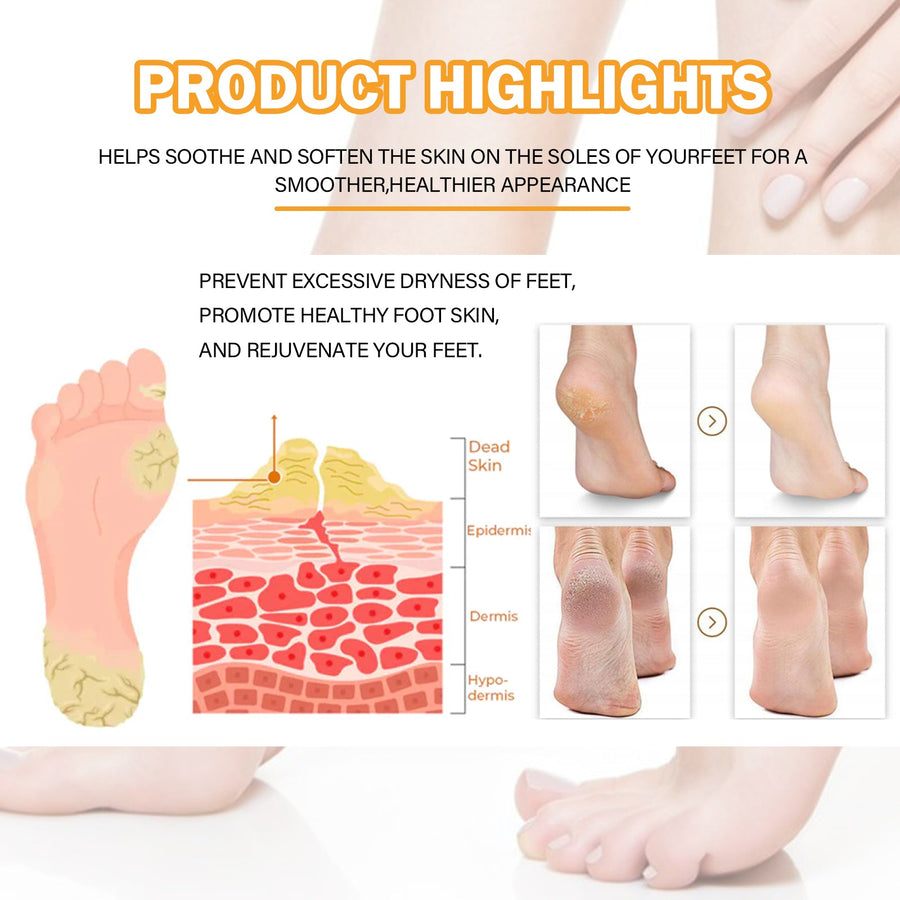 Foot Callus Spray — Smoother, Healthier Heels in One