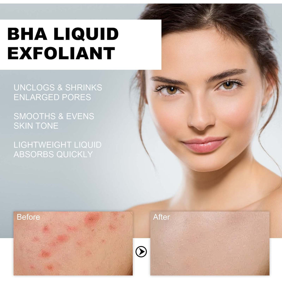 2% BHA Liquid Exfoliant for Clogged Pores & Acne