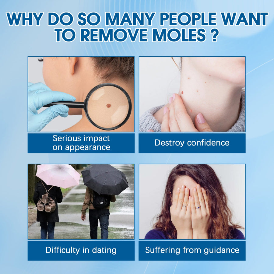 Wart Removal Patches — Safe, Painless 144‑Patch Maximum