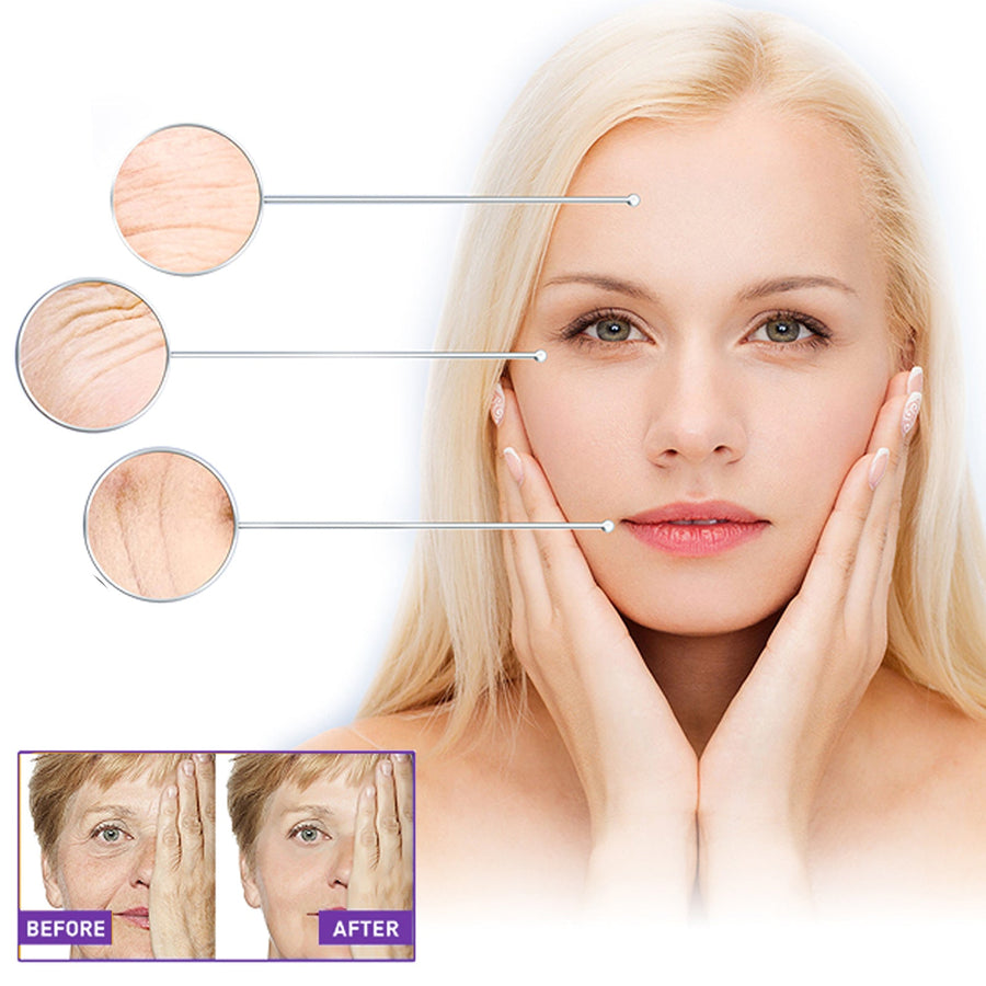 Face Wrinkle Patches — Visible Smoothing & Lifting in 20