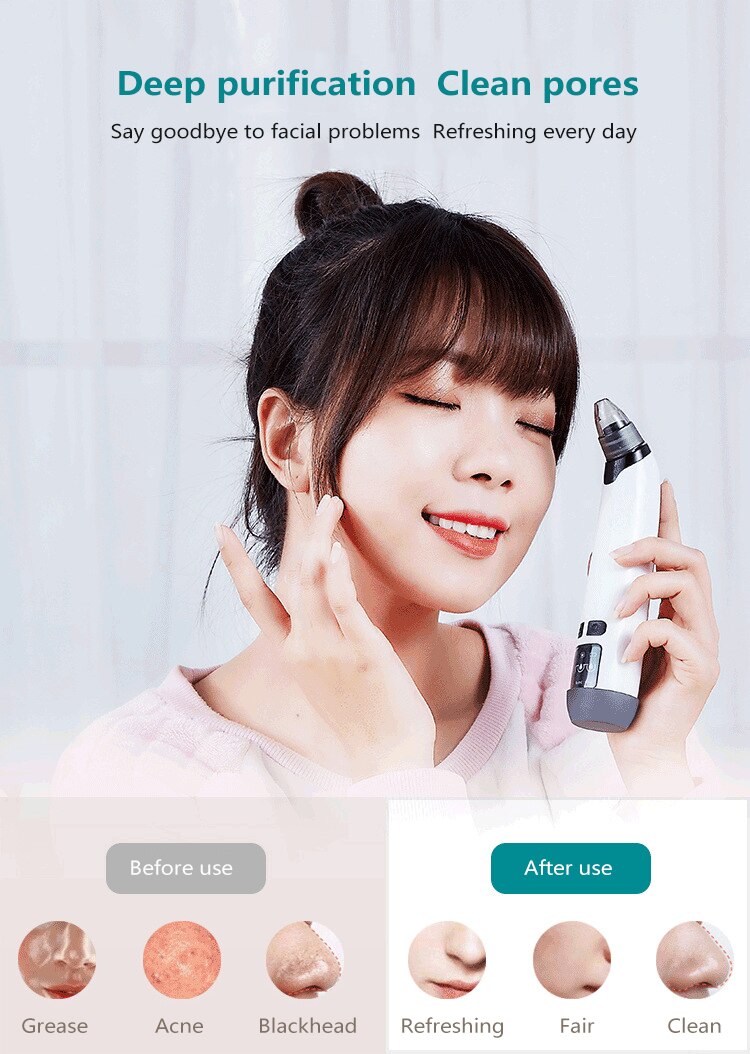 Facial Pore Vacuum Cleaner — Safe Blackhead Removal & Pore
