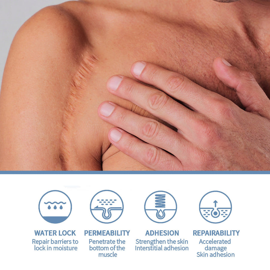 Oceaura Scar Gel: Fade C-Section & Surgery Scars in 8 Weeks