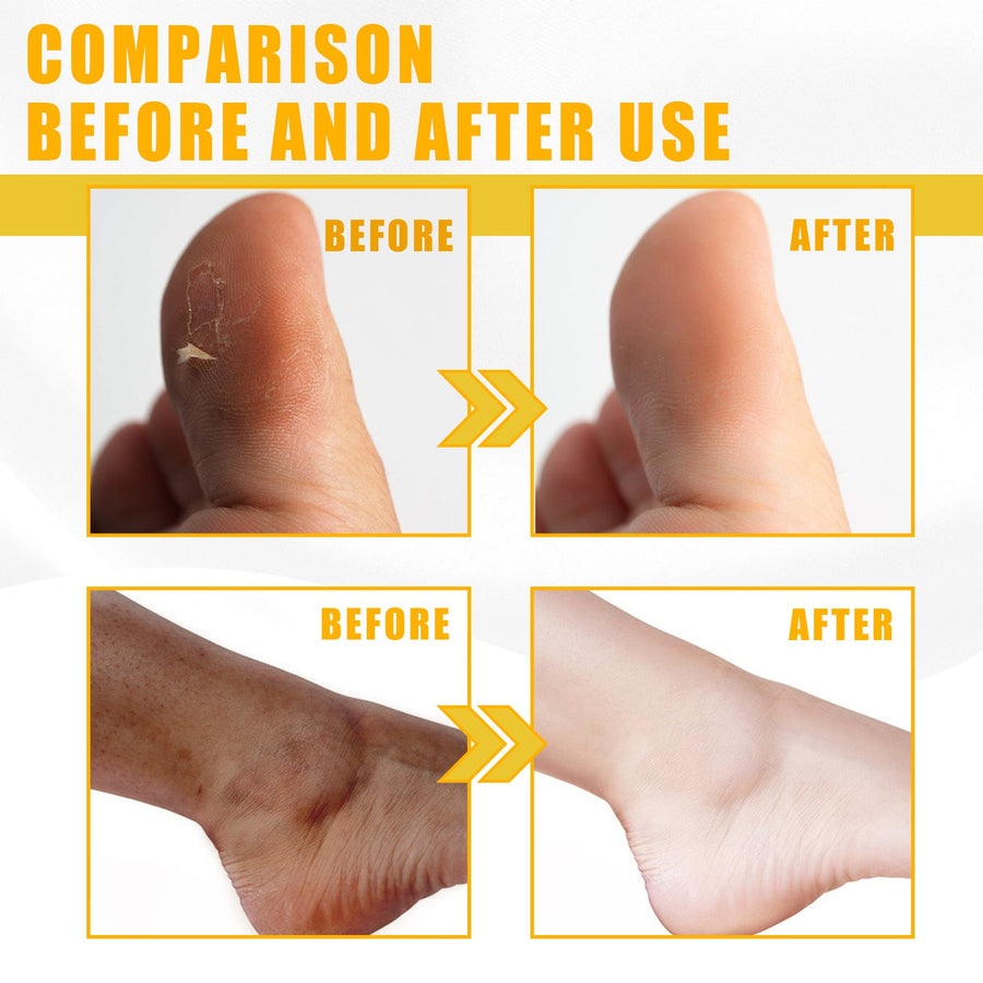 Yellow Peeling Oil for Dull, Uneven Skin Tone