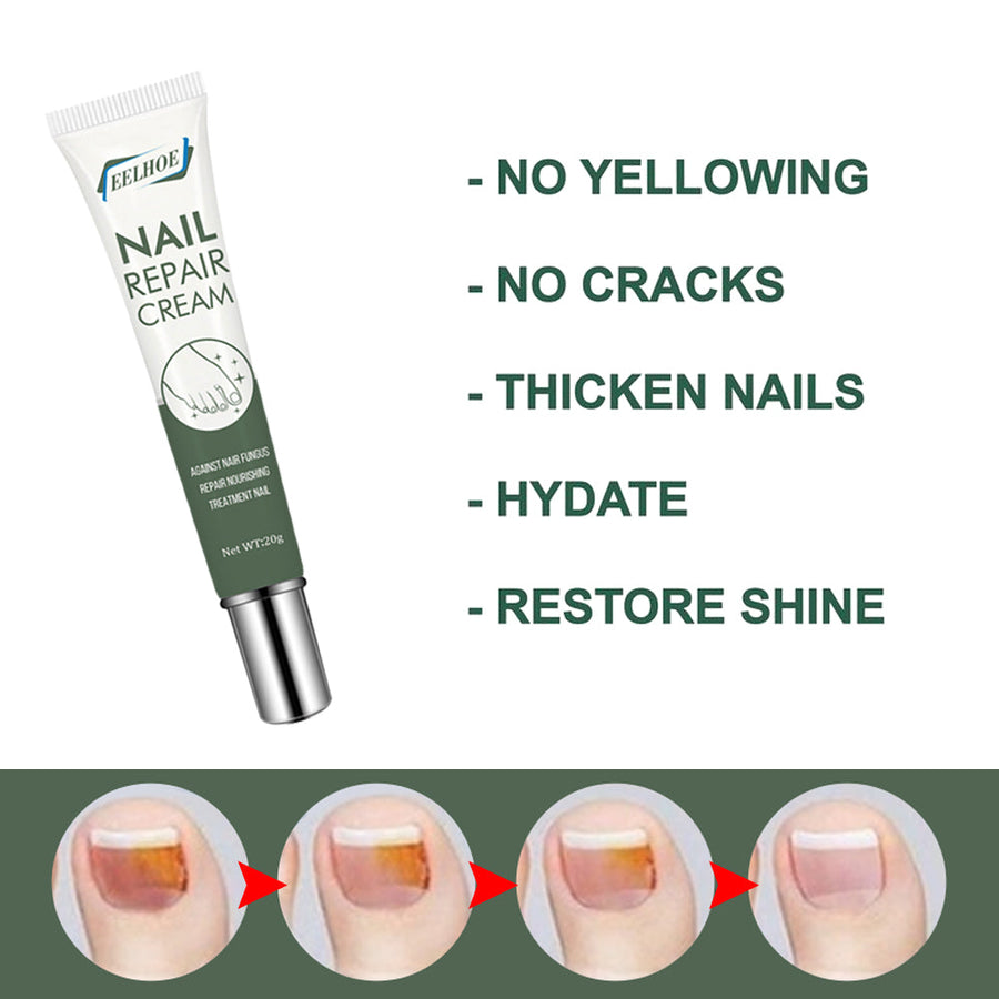 Nail Repair Cream — Clear, Healthy Nails in 4 Weeks