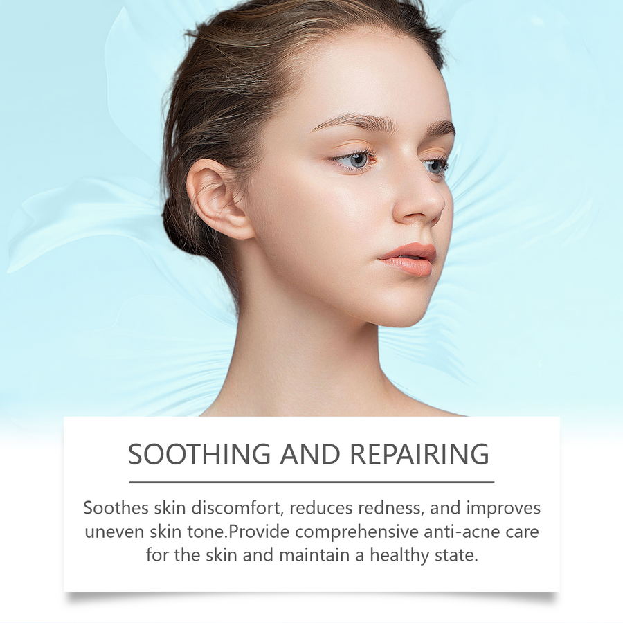 Azelaic Acid 10% Acne Cream — Clears Skin, No Dryness