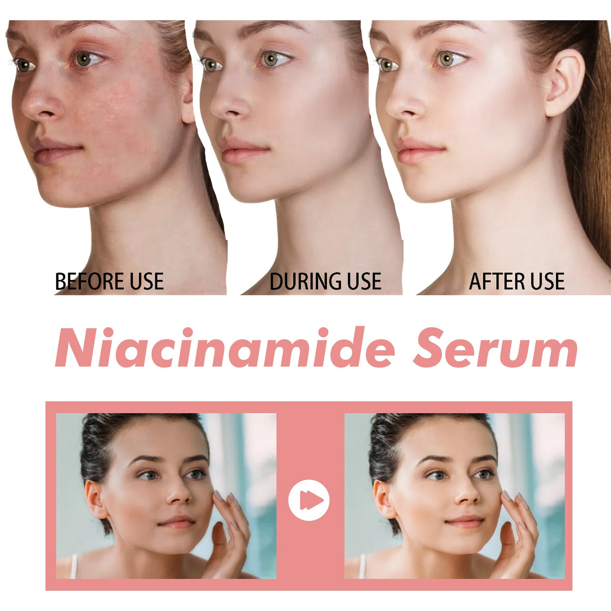 Niacinamide 70% Serum for Pores, Spots & Dull Skin
