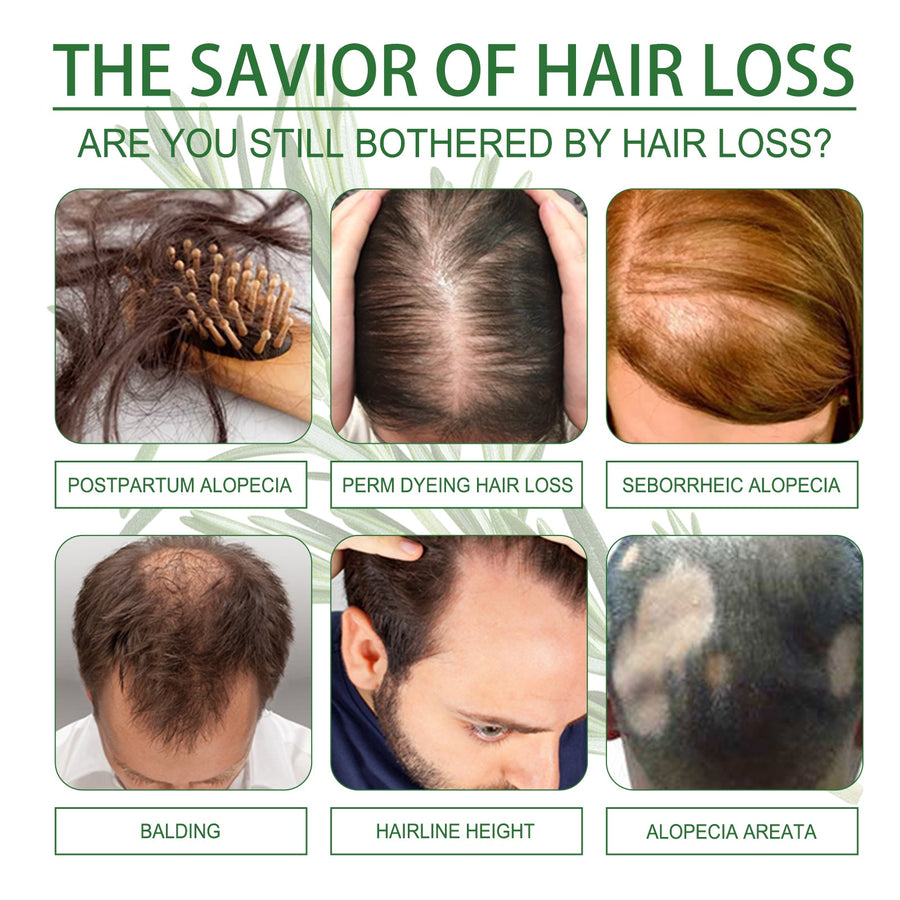 Rosemary Hair Oil for Stronger, Fuller-Looking Hair