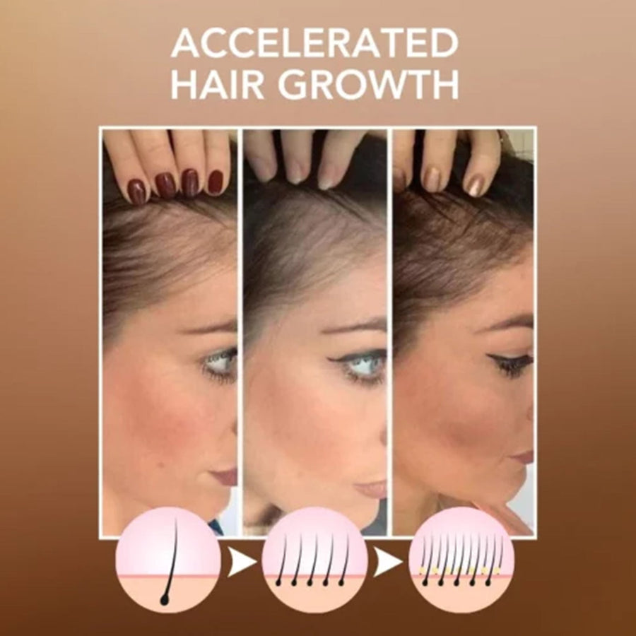 Moroccan Hair Oil for Silky, Shiny, Fuller-Looking Hair