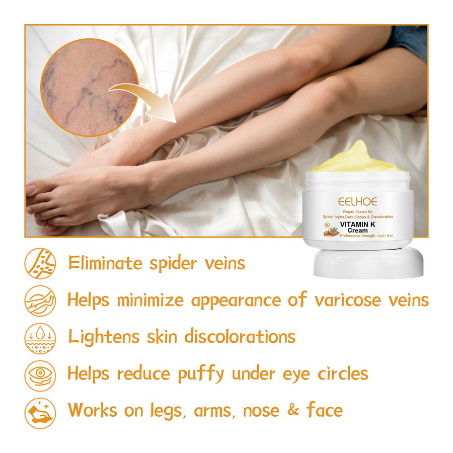 Vitamin K Cream for Spider Veins & Leg Discoloration