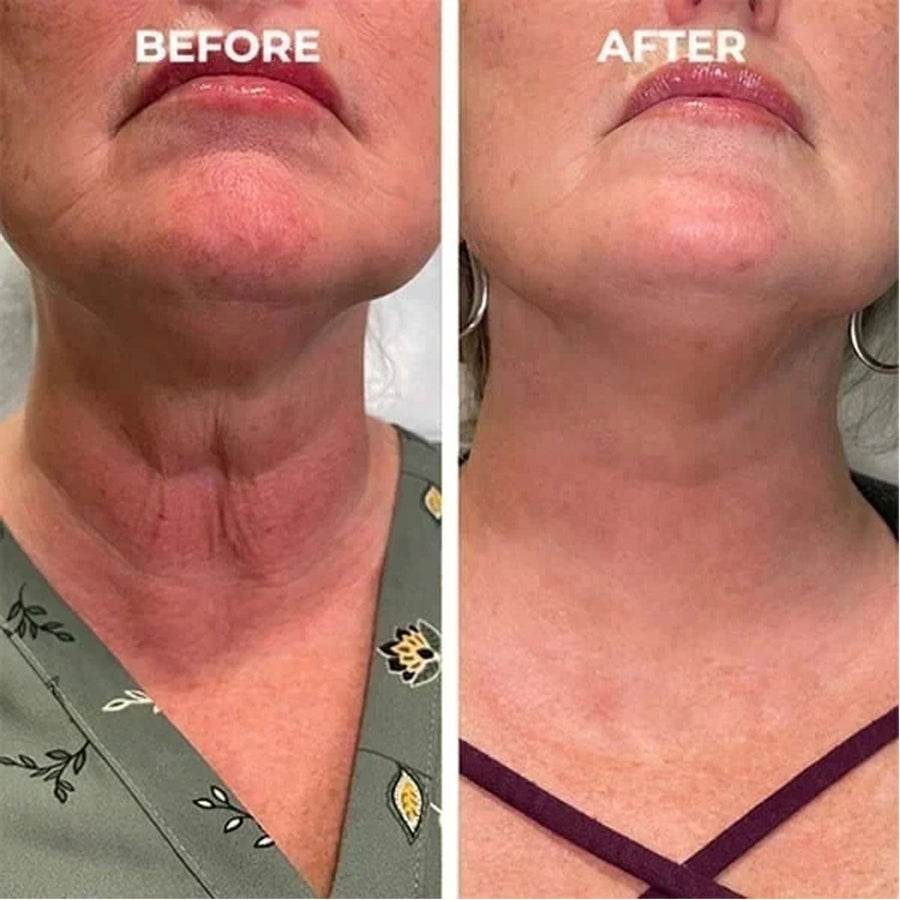 Facial Essence Serum for Deep Wrinkles & Skin Tightening