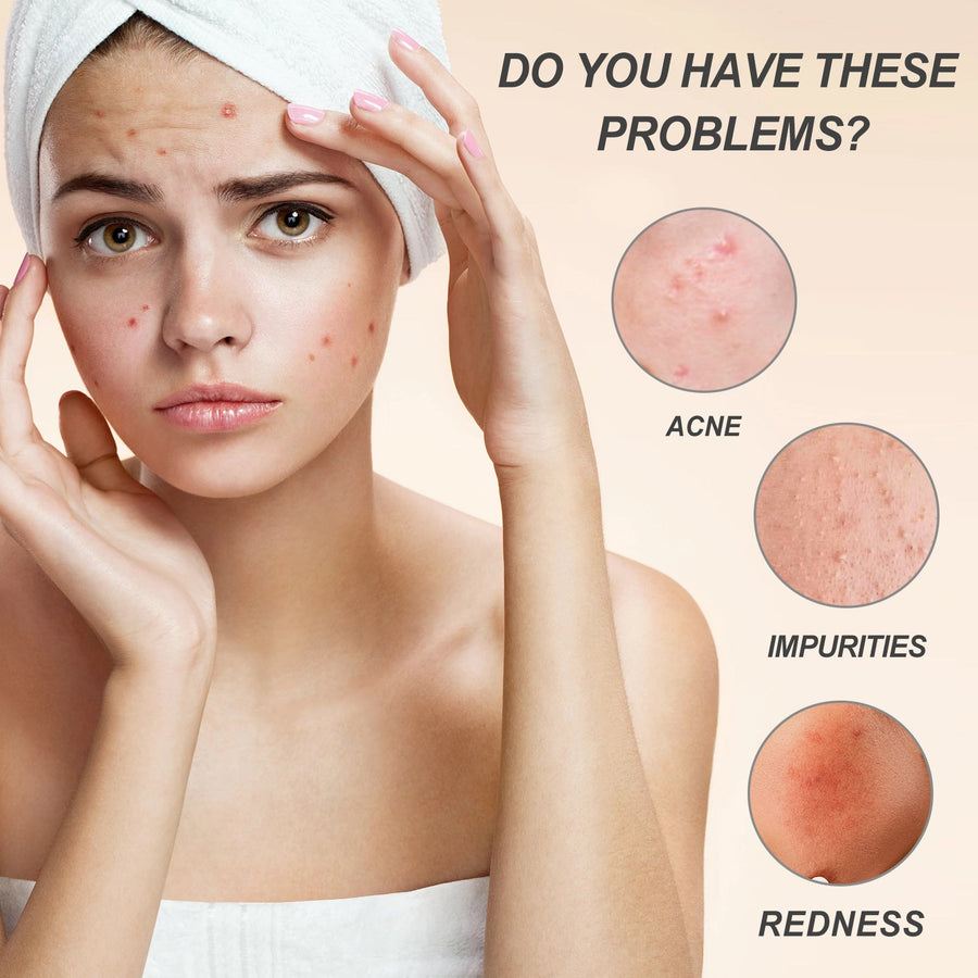 Centella Hydra Cream for Redness, Fine Lines & Dryness