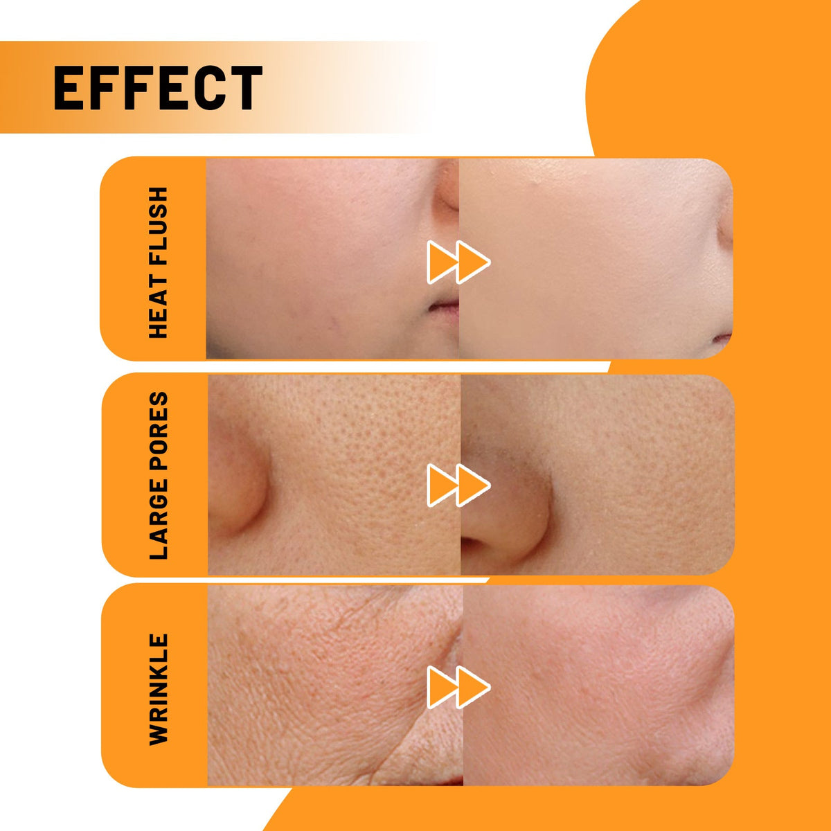 Vitamin C Face Essence for Fine Lines & Uneven Tone