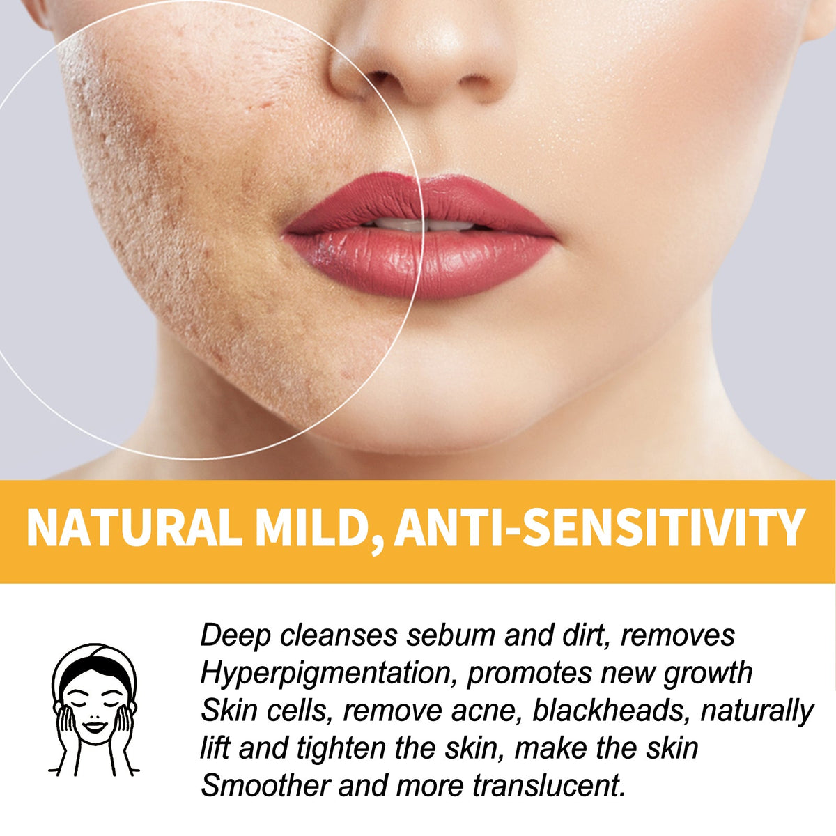 Honey Peel Mask for Blackhead Removal & Brighter Skin