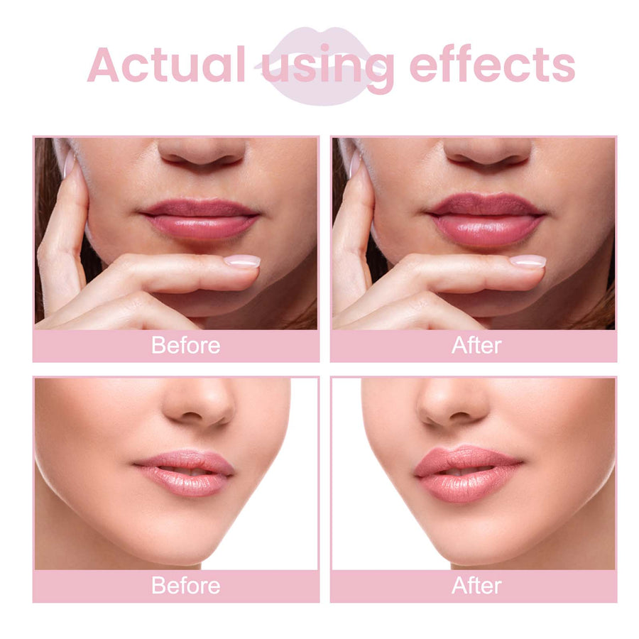 Lip Plumping Serum for Fuller, Smoother Lips