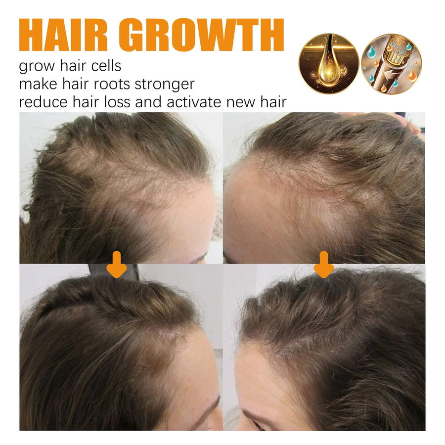 Biotin Hair Oil Roll-On for Fuller-Looking, Shinier Hair