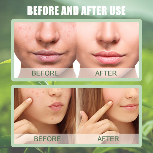 Green Tea Clay Mask Stick for Clean, Balanced Pores
