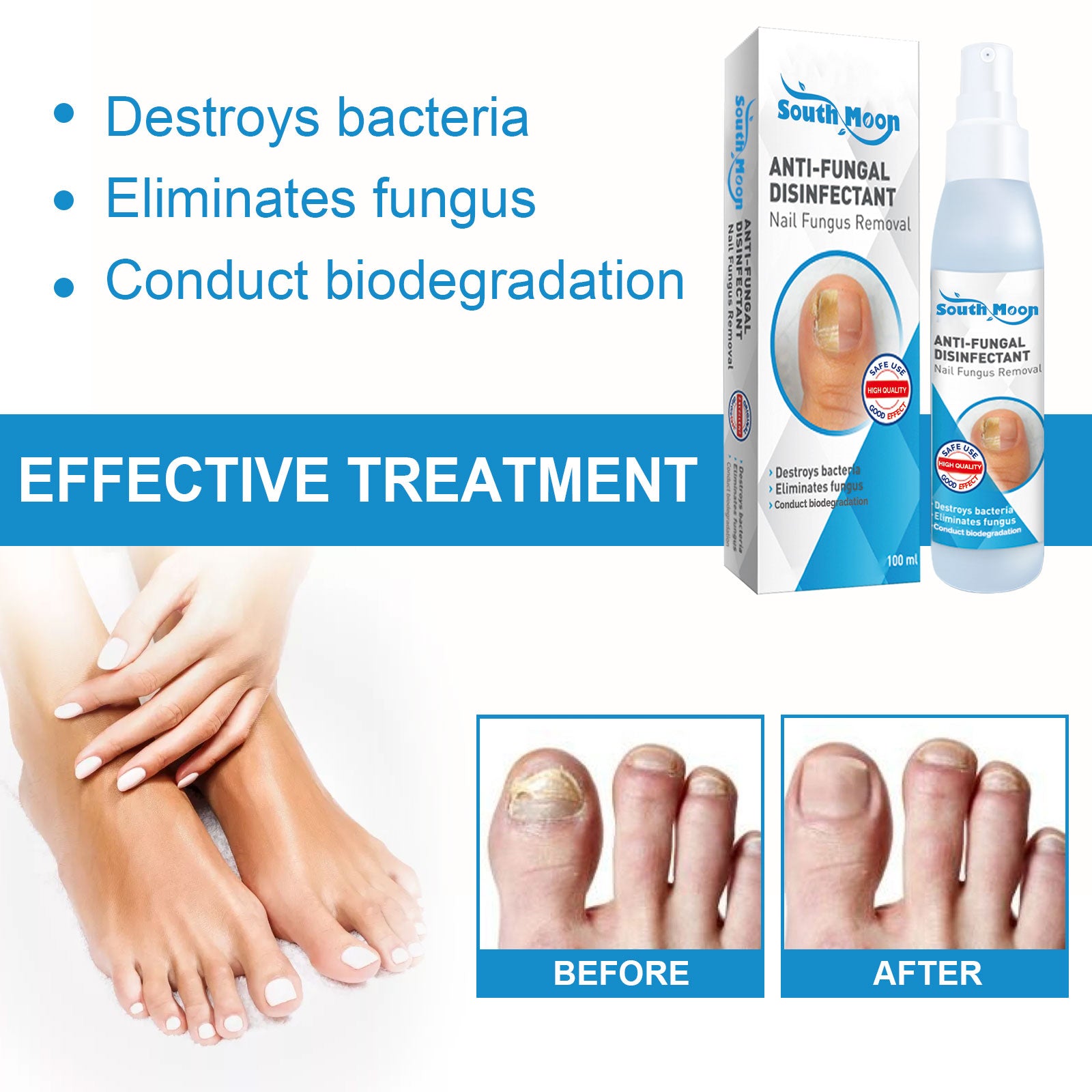 Four-panel before/after grid showing infected yellowed nails transforming to clear healthy nails