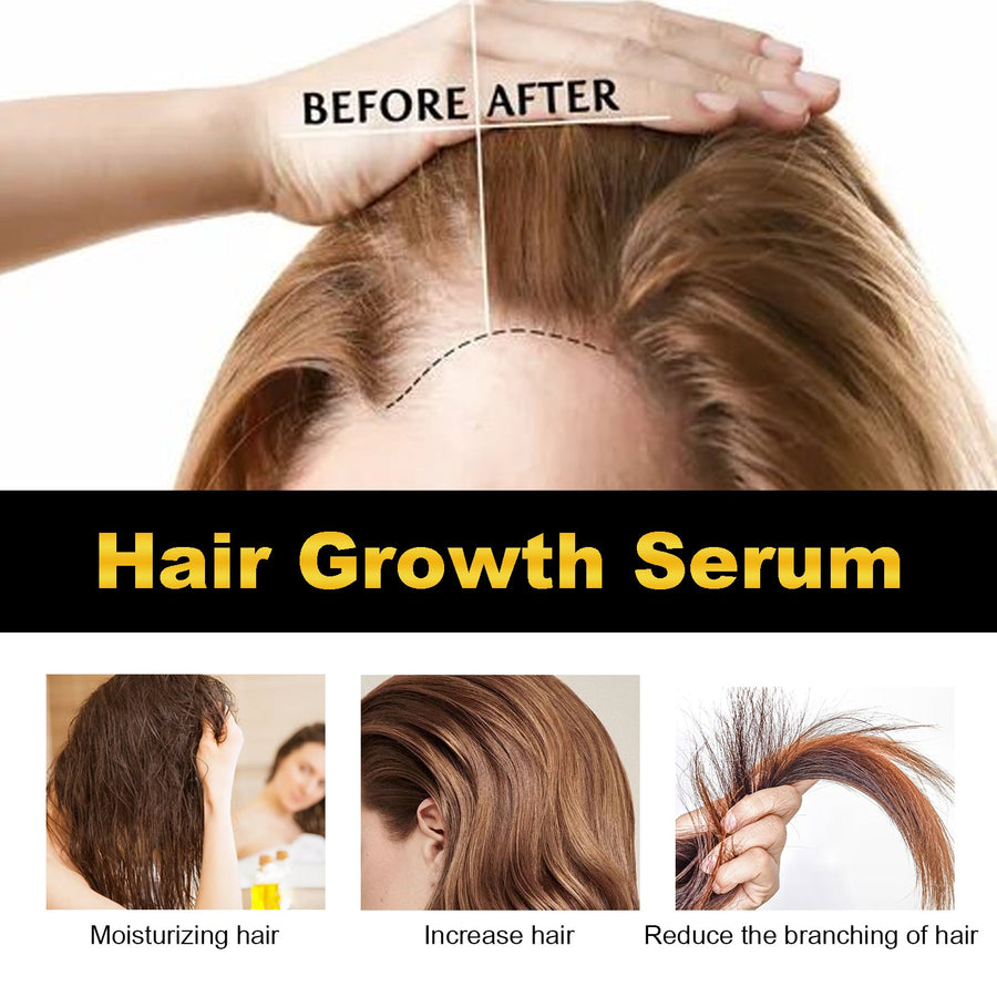 Hair Growth Serum with 5% Castor Oil & Biotin, 30ml