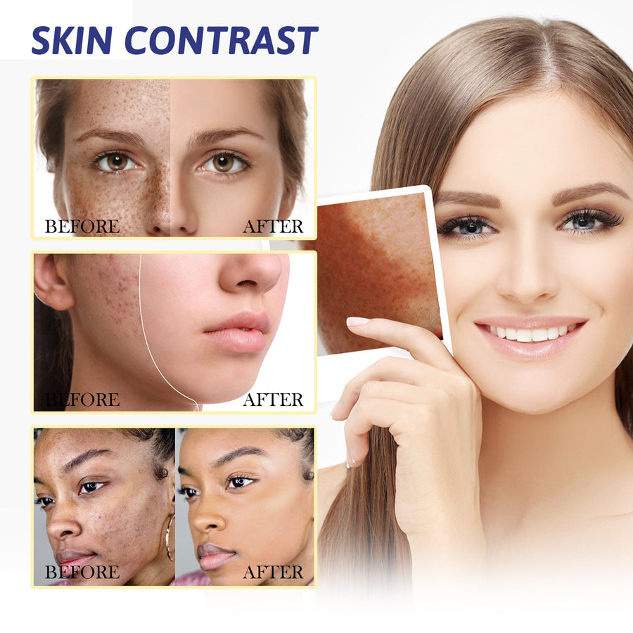 Brightening Cream for Dark Spots & Uneven Skin Tone