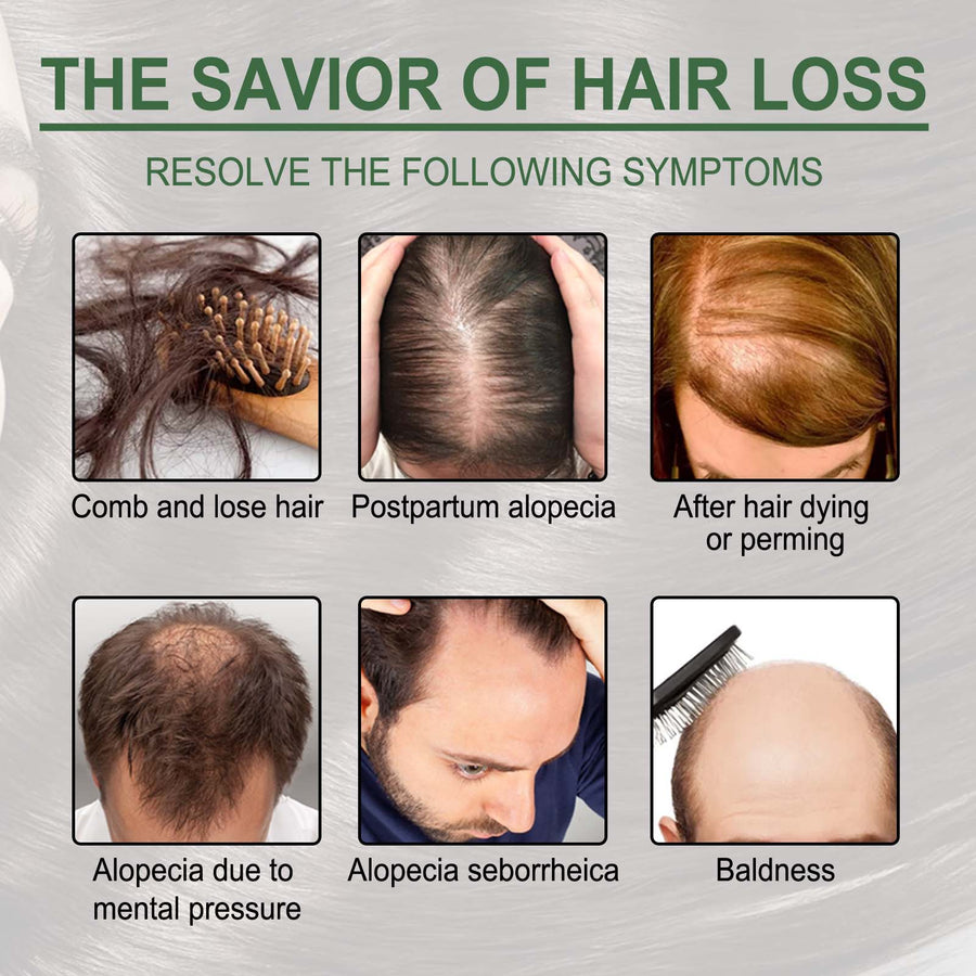 Rosemary Oil Capsules for Stronger, Moisturized Hair