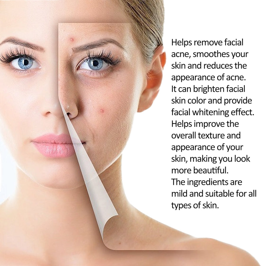 Tea Tree Acne Serum for Clear Skin & Tight Pores