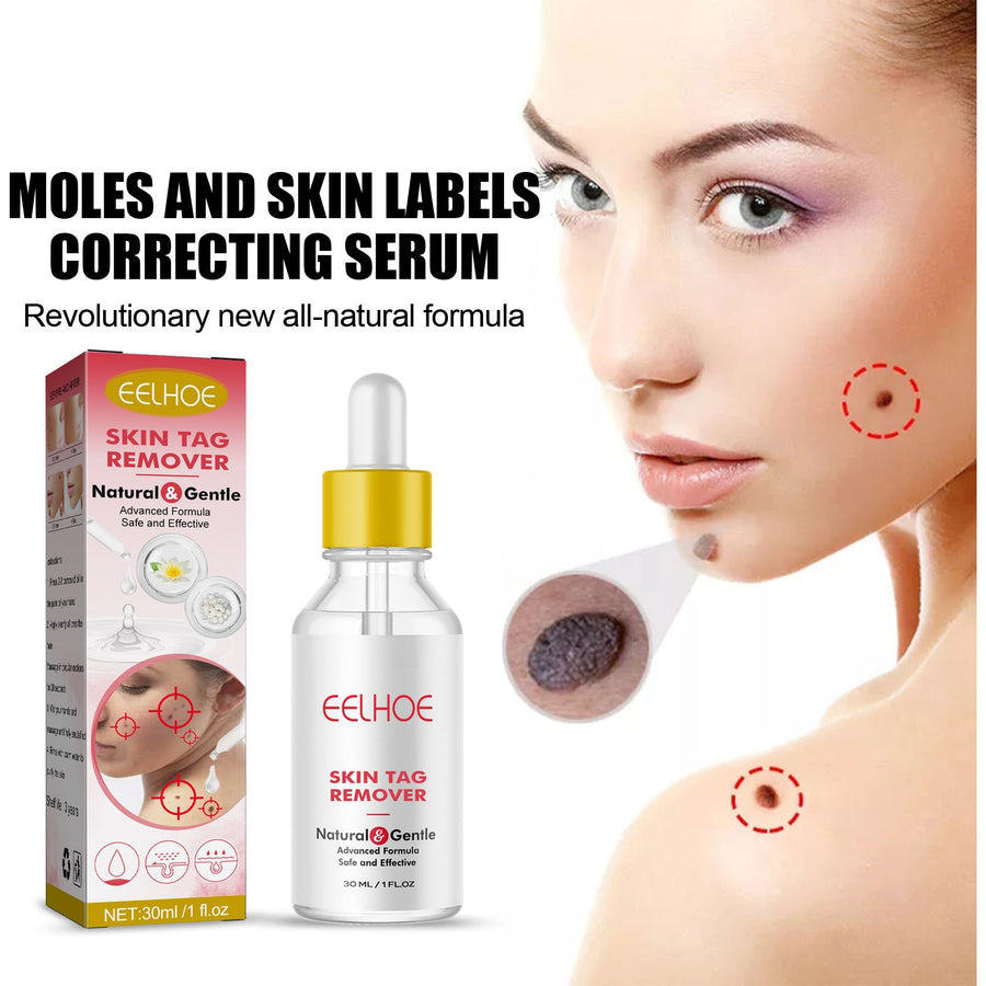 Skin Tag Remover Serum — Remove Moles & Warts Painlessly