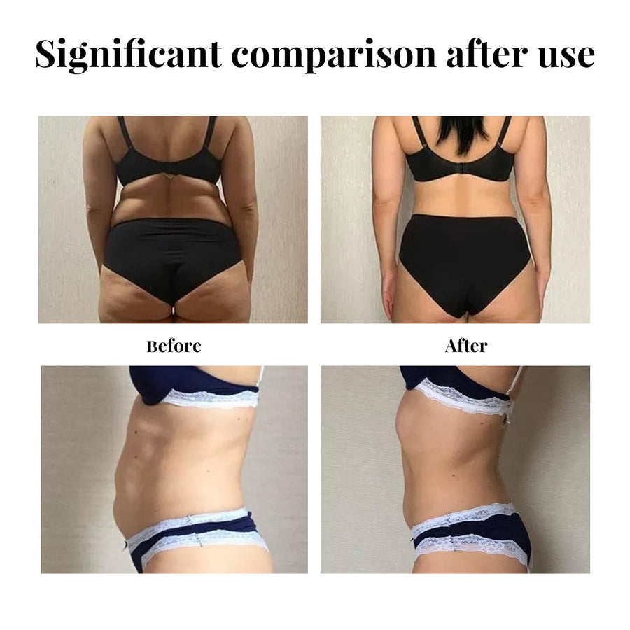Belly Shaping Patches — Tighten & Firm Loose Skin, Organic