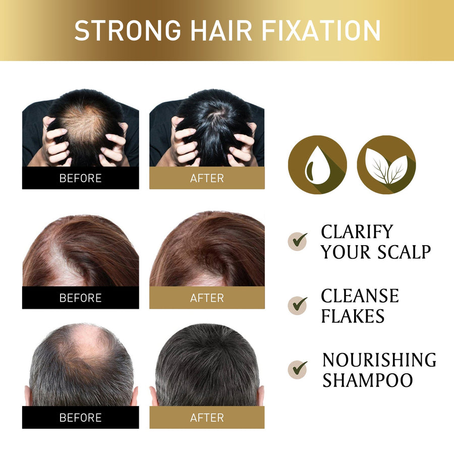 Exfoliating Hair Scrub for Scalp Refresh & Flake Control