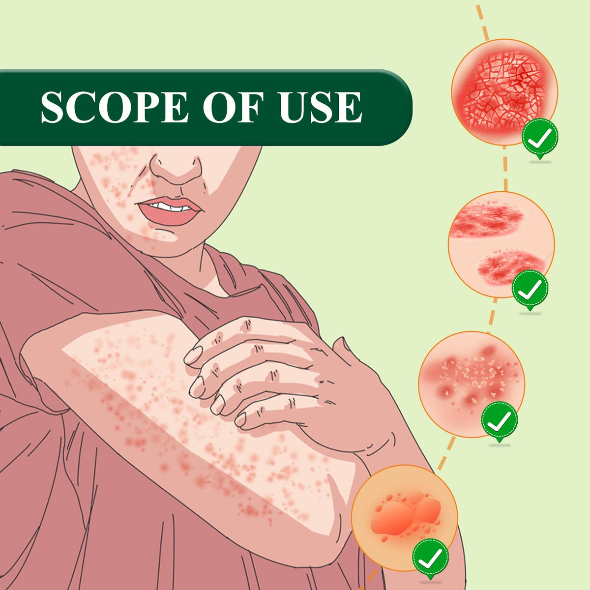 Skin Repair Cream for Shingles Itch & Rash Relief