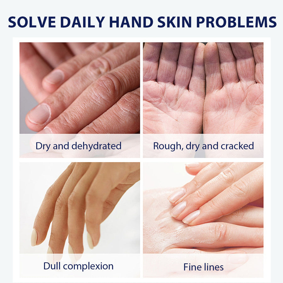 Aloe Vera Hand Cream for Dry, Cracked Skin Repair