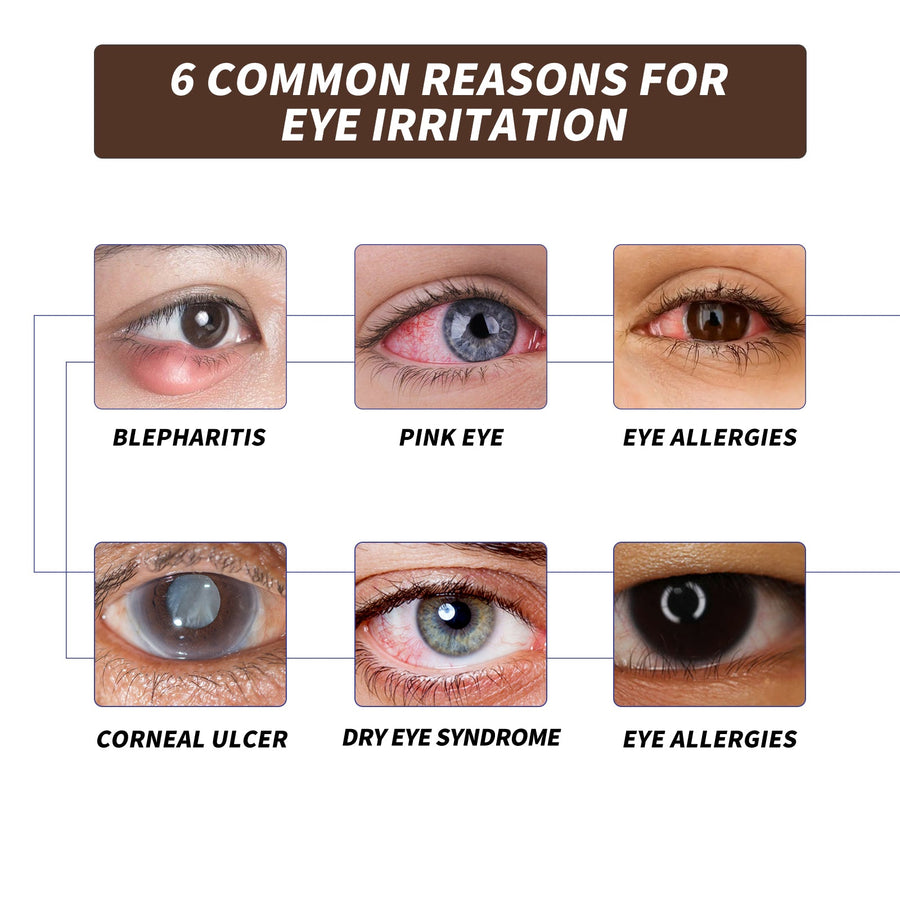 Eye Lubricant Spray — Immediate Relief from Dryness & Redness