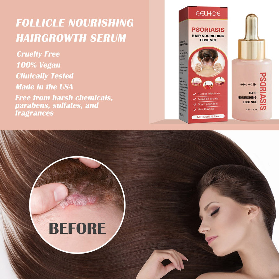 Scalp Nourishing Serum for Dandruff & Itchy Scalp