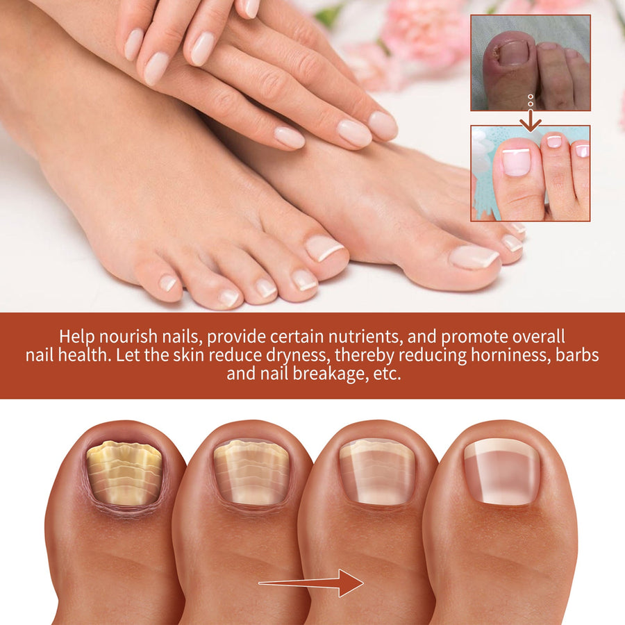 Nail Repair Essence for Discolored Brittle Nails Serum