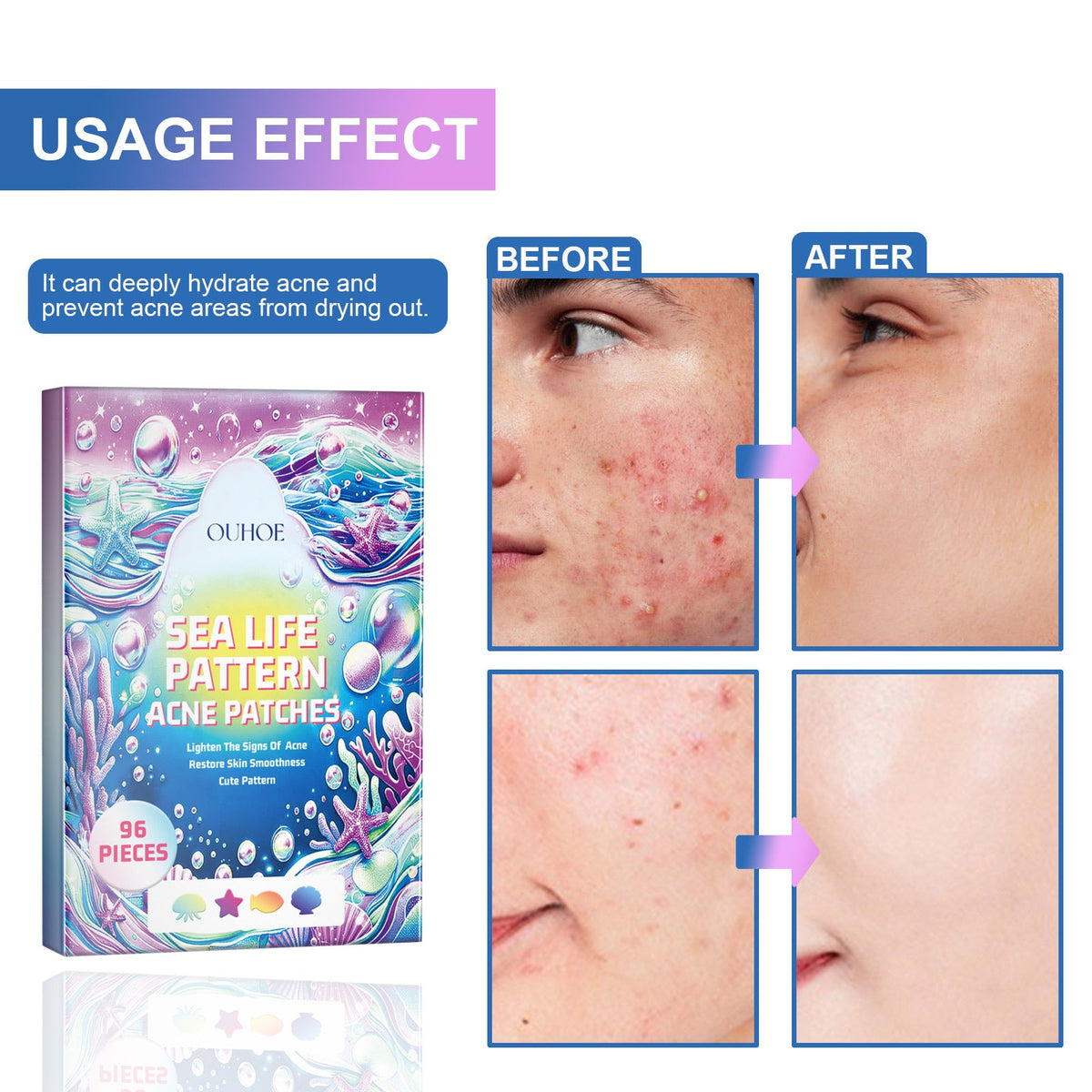 Cute Acne Patches Hydrocolloid 96-Pack Sea Shapes