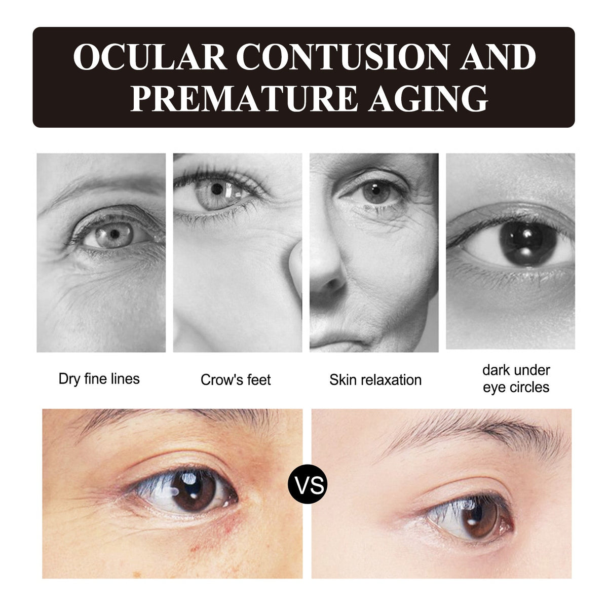 Retinol Eye Cream for Fine Lines & Under-Eye Wrinkles