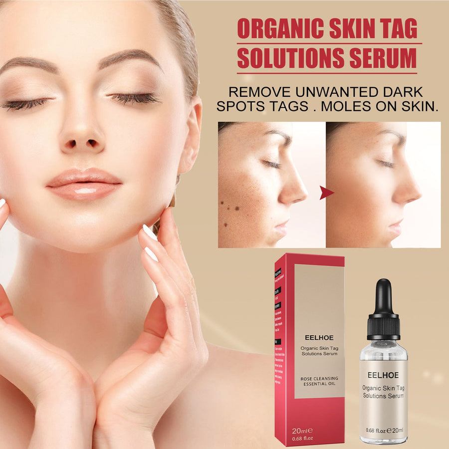 Organic Skin Tag Removal Serum – Clear, Smooth Skin in Weeks