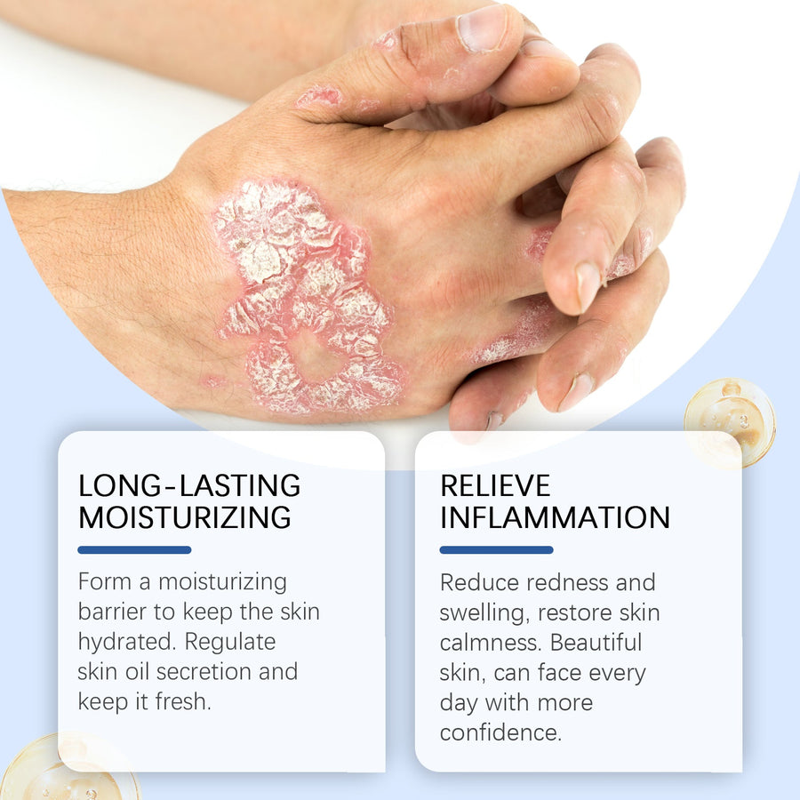 Bee Venom Skin Care Spray for Dry Skin Relief