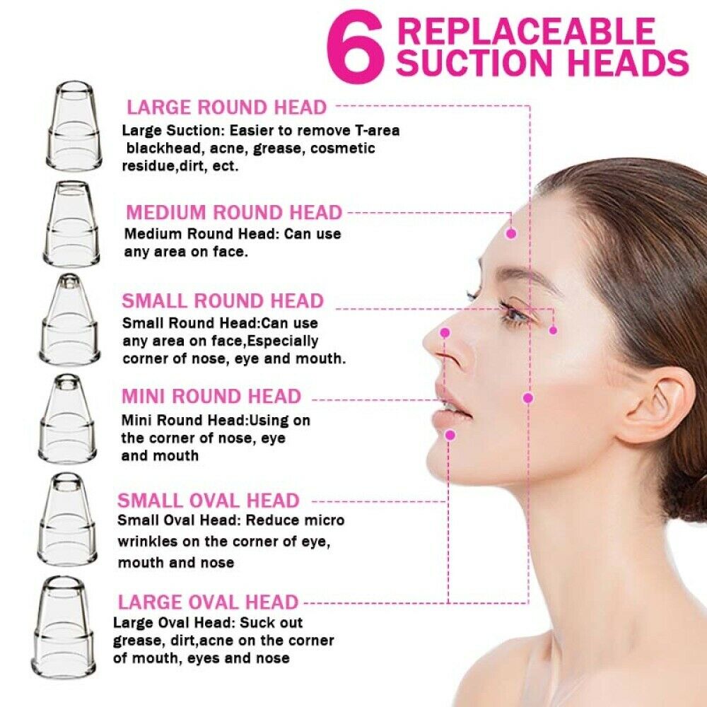Pore Vacuum Blackhead Remover – Deep Cleansing & Clearer Skin